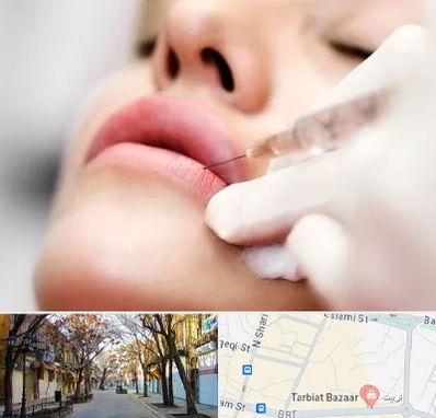 کلینیک تزریق ژل لب در تربیت تبریز