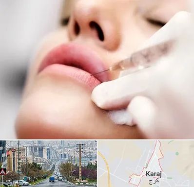 کلینیک تزریق ژل لب در گوهردشت