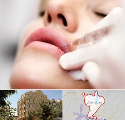 کلینیک تزریق ژل لب در مینی سیتی