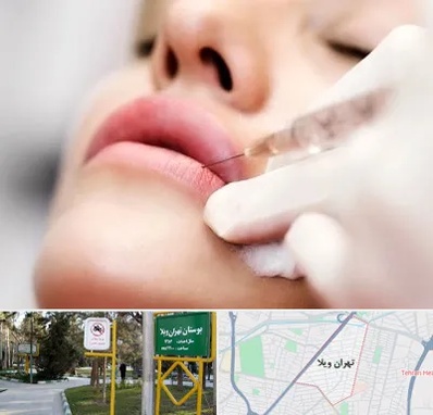کلینیک تزریق ژل لب در تهران ویلا