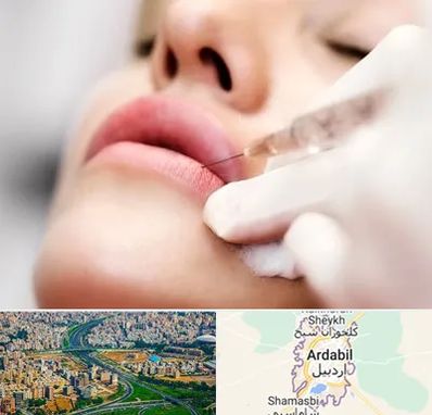 کلینیک تزریق ژل لب در اردبیل