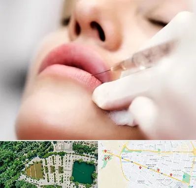 کلینیک تزریق ژل لب در وکیل آباد مشهد
