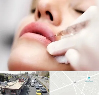 کلینیک تزریق ژل لب در خیابان دماوند