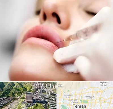 کلینیک تزریق ژل لب در شمال تهران