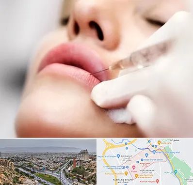 کلینیک تزریق ژل لب در معالی آباد شیراز
