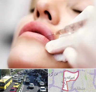 کلینیک تزریق ژل لب در امیرآباد