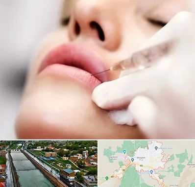 کلینیک تزریق ژل لب در مراغه