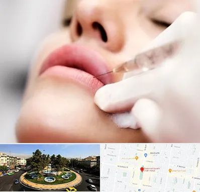 کلینیک تزریق ژل لب در هفت حوض