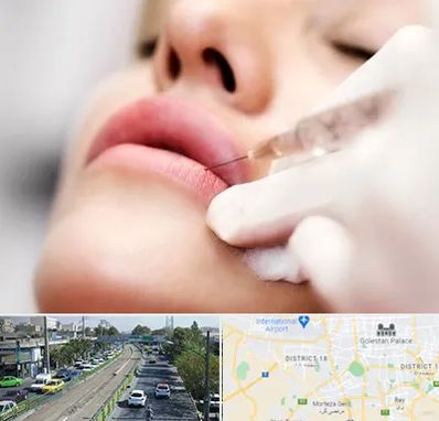 کلینیک تزریق ژل لب در جنوب تهران