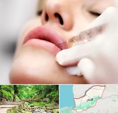کلینیک تزریق ژل لب در گلستان