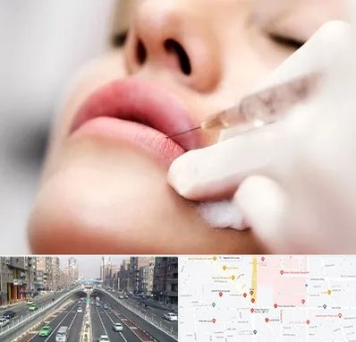 کلینیک تزریق ژل لب در توحید