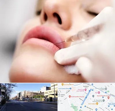 کلینیک تزریق ژل لب در خیابان ملاصدرا شیراز
