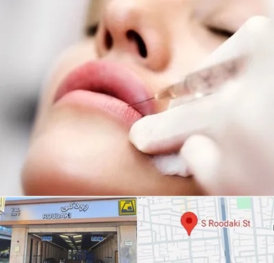 کلینیک تزریق ژل لب در رودکی