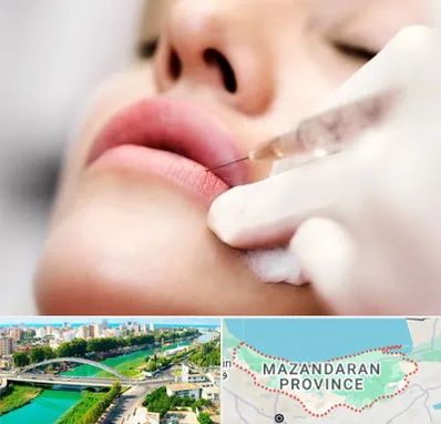 کلینیک تزریق ژل لب در مازندران