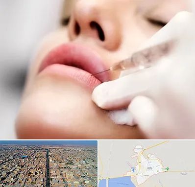 کلینیک تزریق ژل لب در بندر ماهشهر