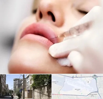 کلینیک تزریق ژل لب در مهرآباد