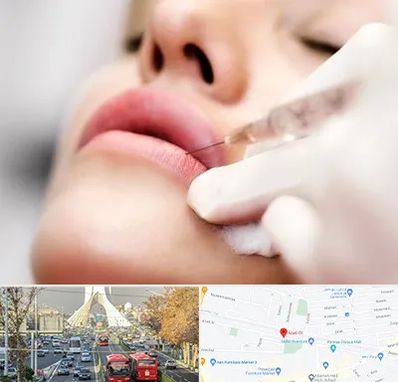 کلینیک تزریق ژل لب در خیابان آزادی