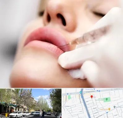کلینیک تزریق ژل لب در کوی فیروز تبریز