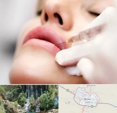کلینیک تزریق ژل لب در شیروان