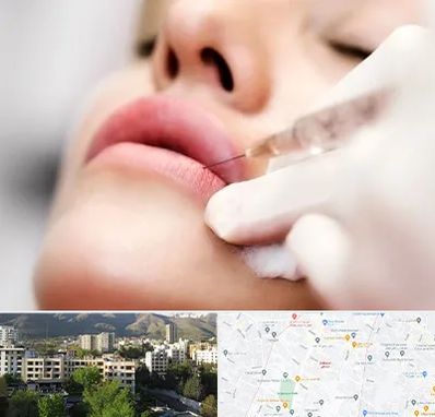 کلینیک تزریق ژل لب در دیباجی