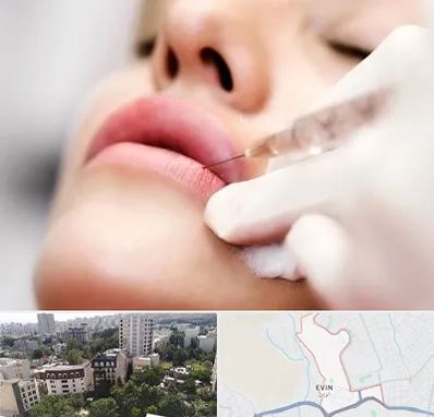 کلینیک تزریق ژل لب در اوین