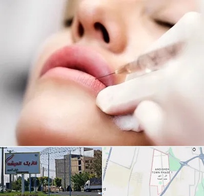 کلینیک تزریق ژل لب در فاز یک اندیشه