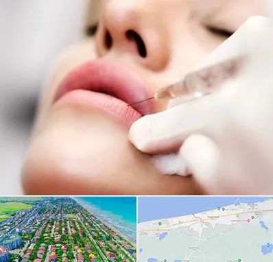 کلینیک تزریق ژل لب در فریدونکنار