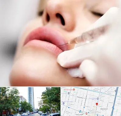 کلینیک تزریق ژل لب در امامت مشهد