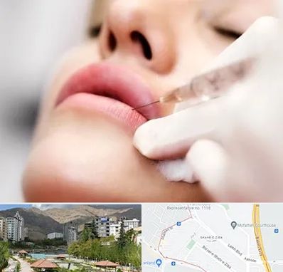 کلینیک تزریق ژل لب در شهر زیبا