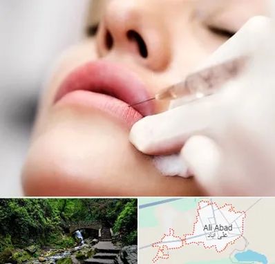 کلینیک تزریق ژل لب در علی‌ آباد کتول