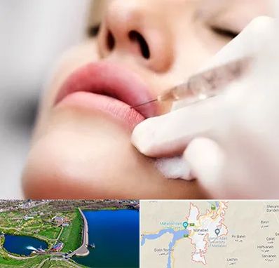 کلینیک تزریق ژل لب در مهاباد