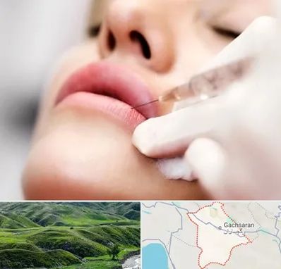 کلینیک تزریق ژل لب در گچساران