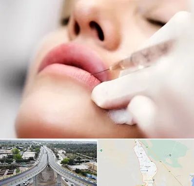 کلینیک تزریق ژل لب در اندیمشک