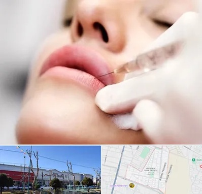کلینیک تزریق ژل لب در فاز دو اندیشه