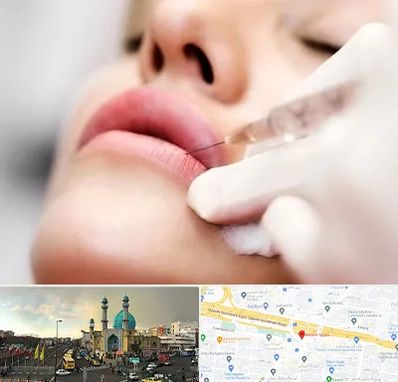 کلینیک تزریق ژل لب در رسالت