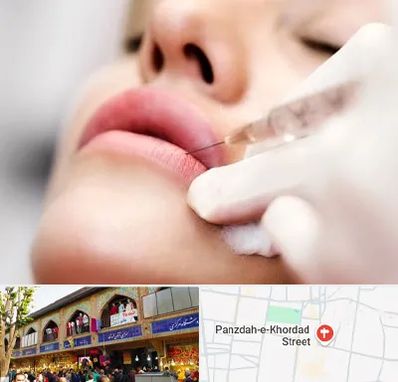 کلینیک تزریق ژل لب در 15 خرداد