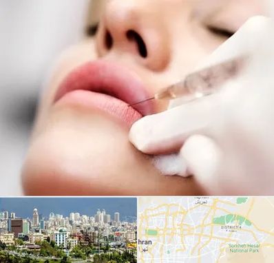 کلینیک تزریق ژل لب در شرق تهران