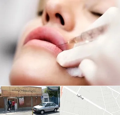 کلینیک تزریق ژل لب در وردآورد