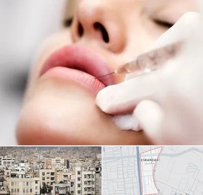 کلینیک تزریق ژل لب در اسکندری
