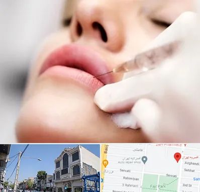 کلینیک تزریق ژل لب در افسریه