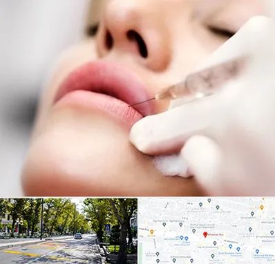 کلینیک تزریق ژل لب در میرداماد