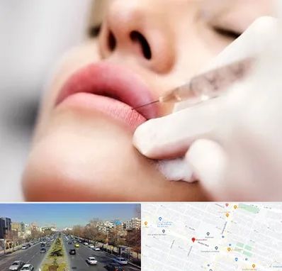 کلینیک تزریق ژل لب در بلوار معلم مشهد