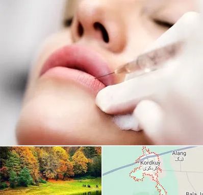 کلینیک تزریق ژل لب در کردکوی