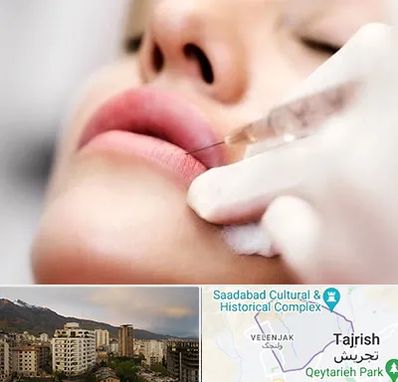 کلینیک تزریق ژل لب در زعفرانیه