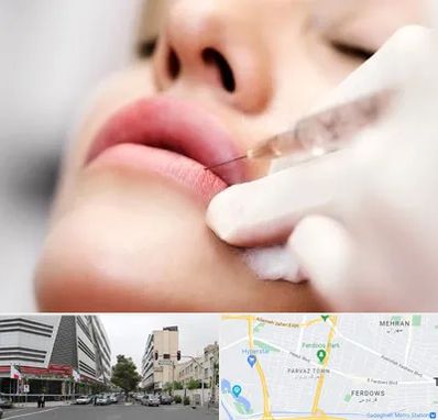 کلینیک تزریق ژل لب در بلوار فردوس