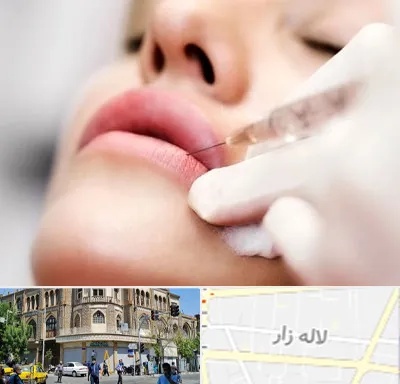 کلینیک تزریق ژل لب در لاله زار