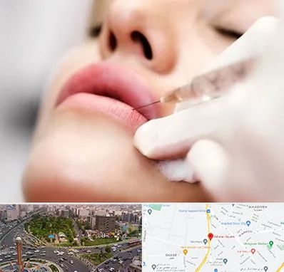 کلینیک تزریق ژل لب در سبلان