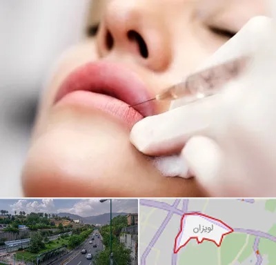 کلینیک تزریق ژل لب در لویزان