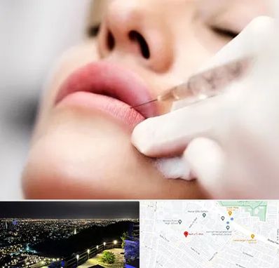 کلینیک تزریق ژل لب در هفت تیر مشهد