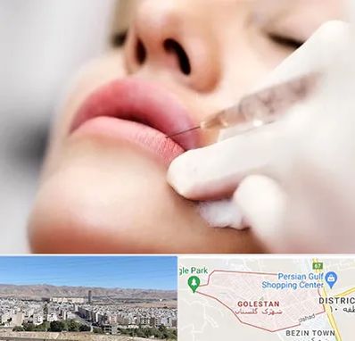 کلینیک تزریق ژل لب در شهرک گلستان شیراز